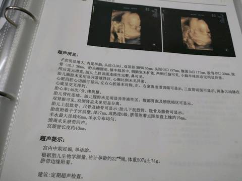 journal_insert_pic_1579703058