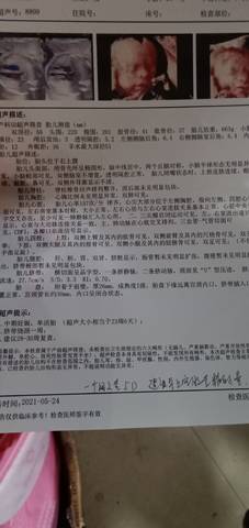 journal_insert_pic_1582027934