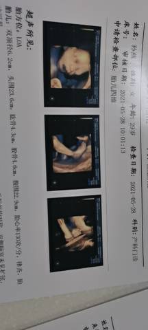 journal_insert_pic_1583422579