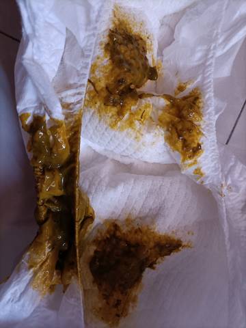 7个月的宝宝拉这样的便便正常吗?