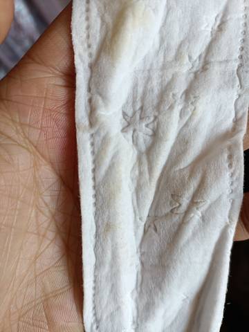 我这样的分泌物正常吗?