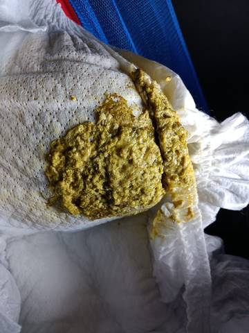 宝宝便便带奶瓣,有时希有时干,一天排4.