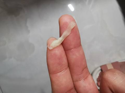 怀孕7 3,这两天老是有这种分泌物,正常不