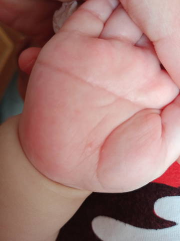 有没有哪个宝妈知道宝宝手心里红红起的是啥