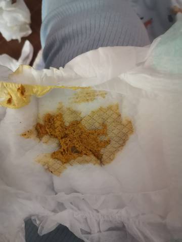 宝宝拉这样的便便是正常吗?