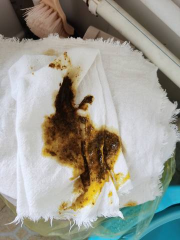 出生六天了,拉这样的粑粑正常吗