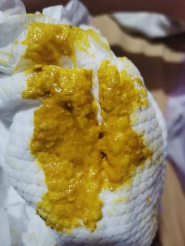 之前都是一天最多两次 这两天都是一天四五次粑粑_育儿问答_宝宝树