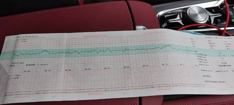我想问下大家,胎心监护8分,算过了吗,有能看懂的吗,大夫建议再重新查