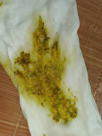 宝宝拉粘液便便