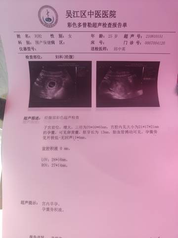 8周孕囊大小图片