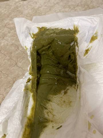 我家宝宝54天喝深度水解奶粉,现在换成部分水解奶粉5天了,每天大便