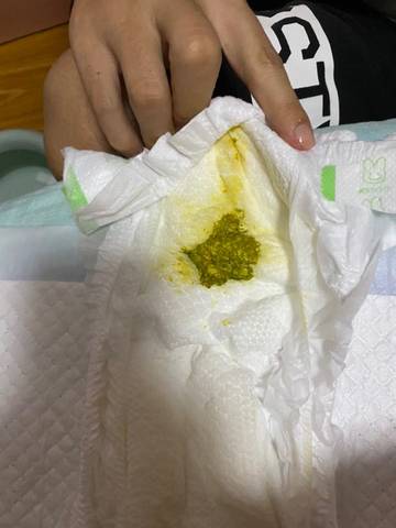 纯母乳,45天宝宝大便绿色说明什么?谢谢医生