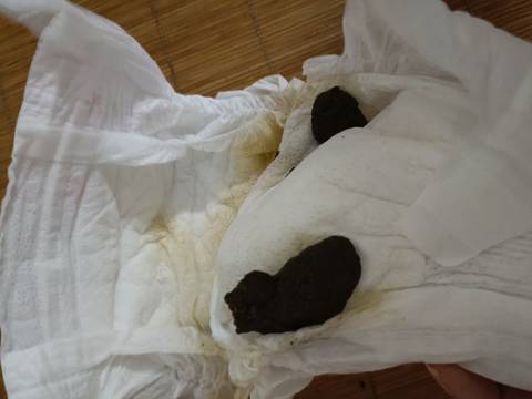 七个月宝宝为什么拉这样的臭臭?