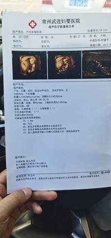 journal_insert_pic_1630298353