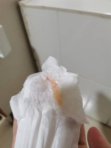 已经14周了 突然上厕所发现有分泌物这样 是出血吗 还是什么问题 没有任何不适 宝宝树