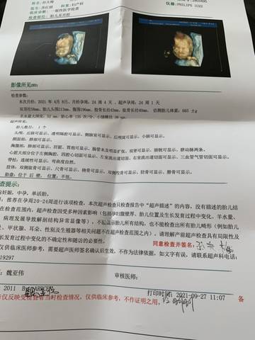journal_insert_pic_1636393184