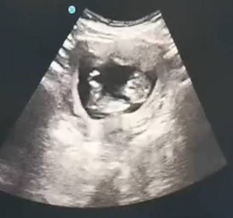 journal_insert_pic_1675314256