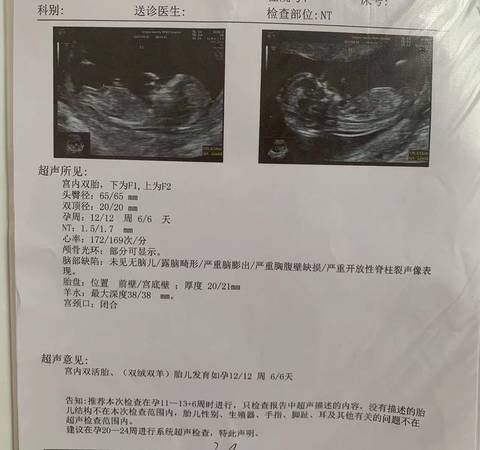 journal_insert_pic_1758945207