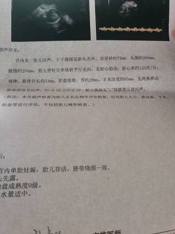 journal_insert_pic_2035419501