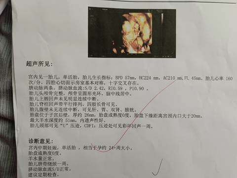 journal_insert_pic_4079611441