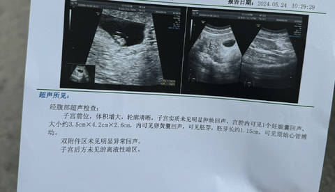 journal_insert_pic_4112593740