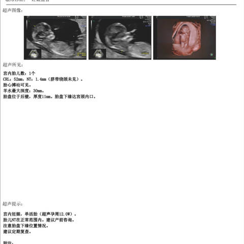 journal_insert_pic_4121061436