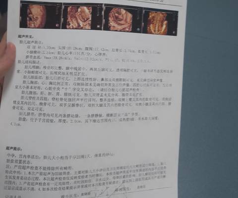 journal_insert_pic_4412134481