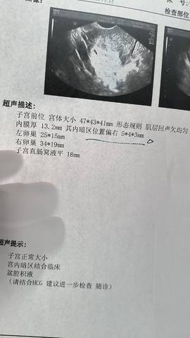 journal_insert_pic_4413751627