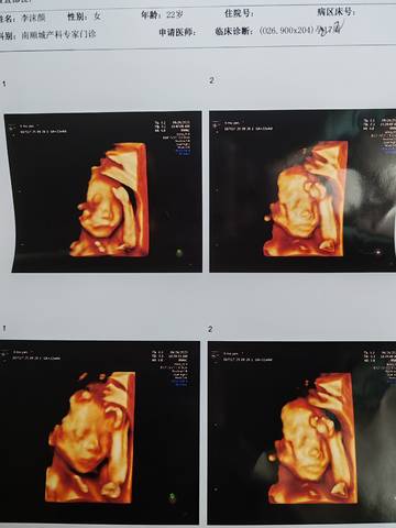 journal_insert_pic_4414008350