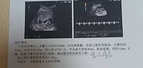 journal_insert_pic_4415308199