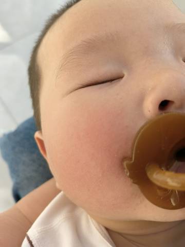宝宝脸上泛红 还特别干 这几天疯狂冒痘有没有宝妈推荐好用一点的保湿霜